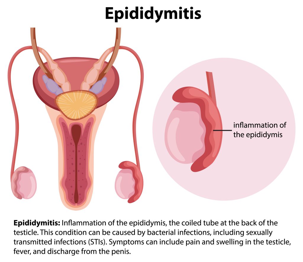 Testicular Pain Treatment in Mumbai