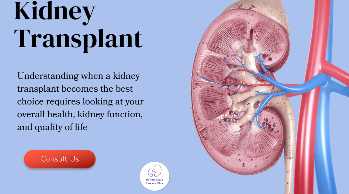 Kidney Transplant specialist in Mumbai