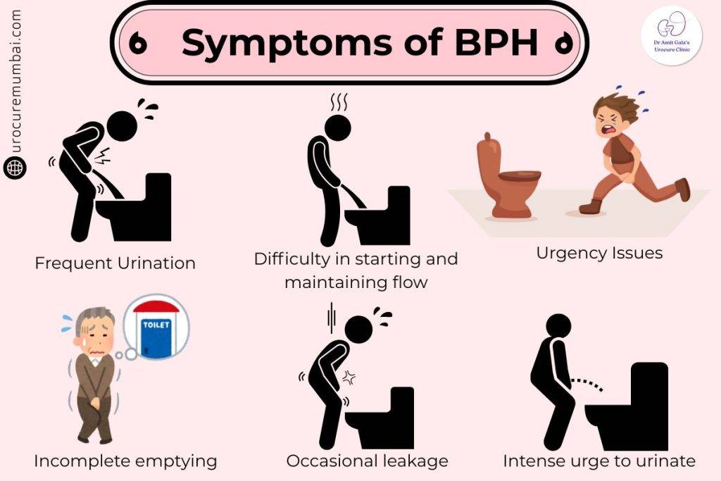 Symptoms of BPH