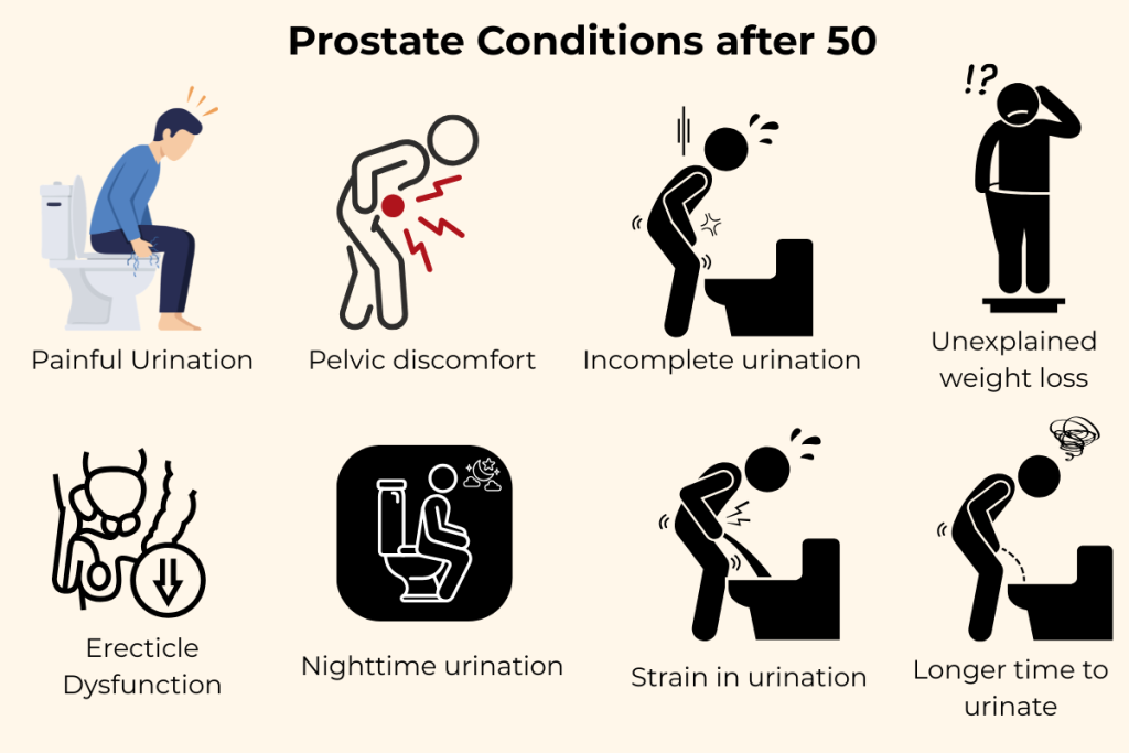 Prostate conditions after 50 treatment