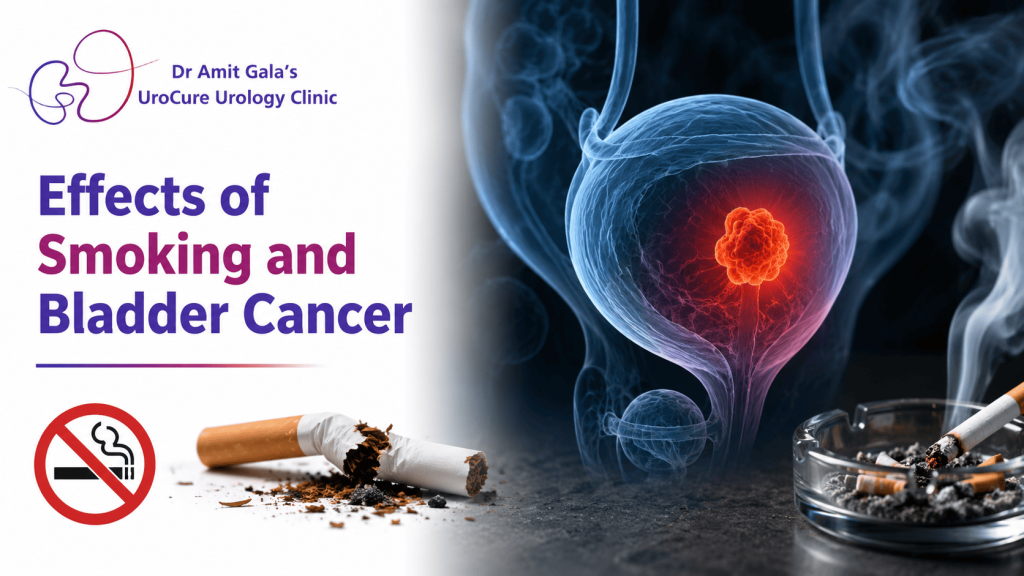 Smoking and bladder cancer